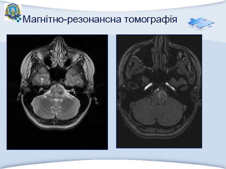 v. Магнітно-резонансна томографія 