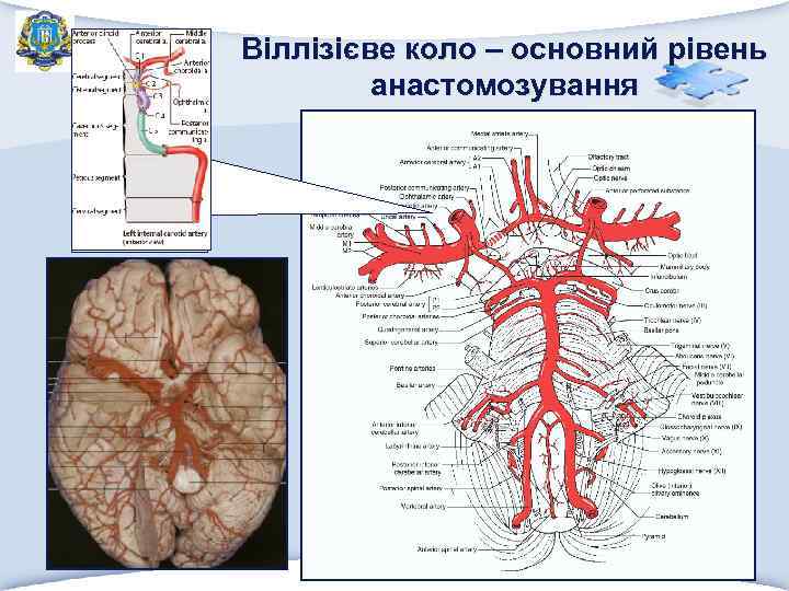 Віллізієве коло – основний рівень анастомозування 