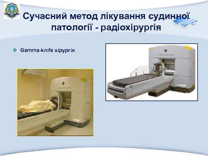 Сучасний метод лікування судинної патології - радіохірургія v Gamma-knife хірургія 