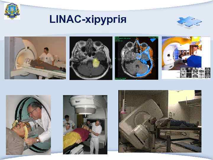 LINAC-хірургія 