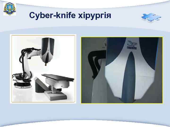 Cyber-knife хірургія 