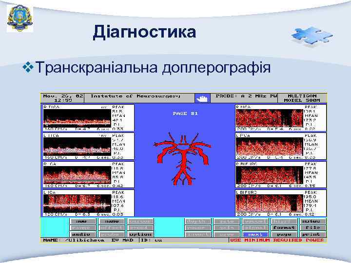 Діагностика v. Транскраніальна доплерографія 