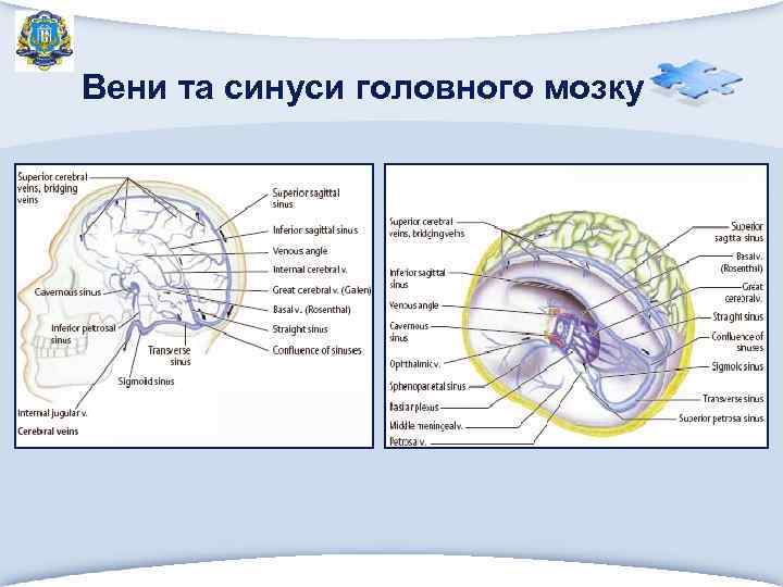 Вени та синуси головного мозку 