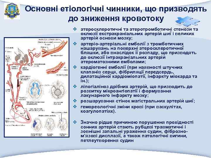 Основні етіологічні чинники, що призводять до зниження кровотоку v атеросклеротичні та атеротромботичні стенози та