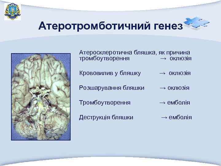 Атеротромботичний генез Атеросклеротична бляшка, як причина тромбоутворення → оклюзія Крововилив у бляшку → оклюзія