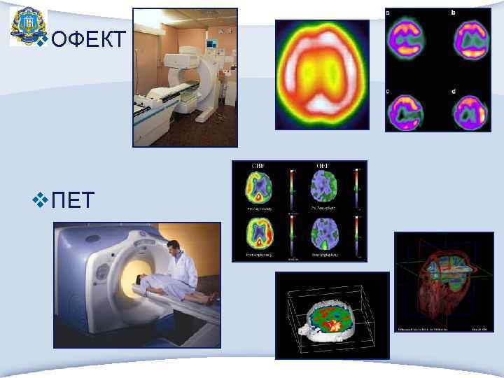 v. ОФЕКТ v. ПЕТ 