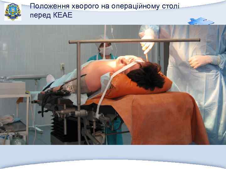 Положення хворого на операційному столі перед КЕАЕ 