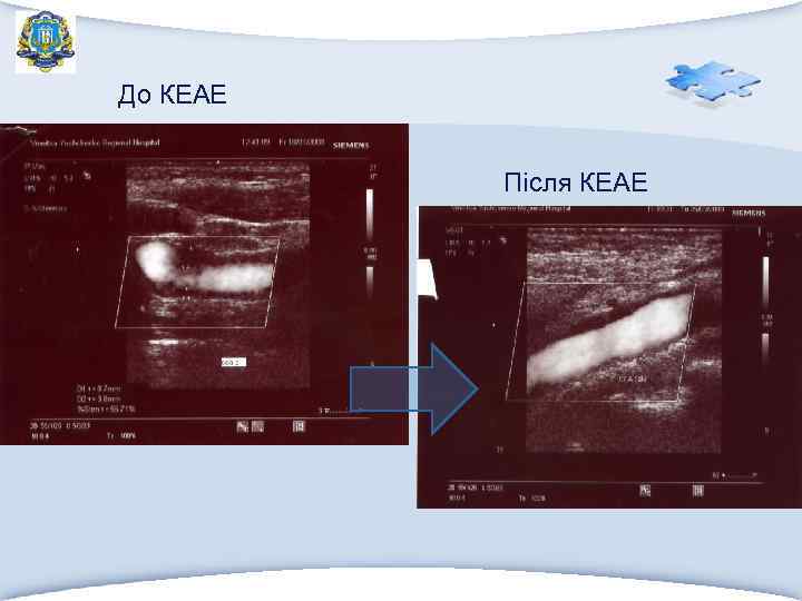 До КЕАЕ Після КЕАЕ 