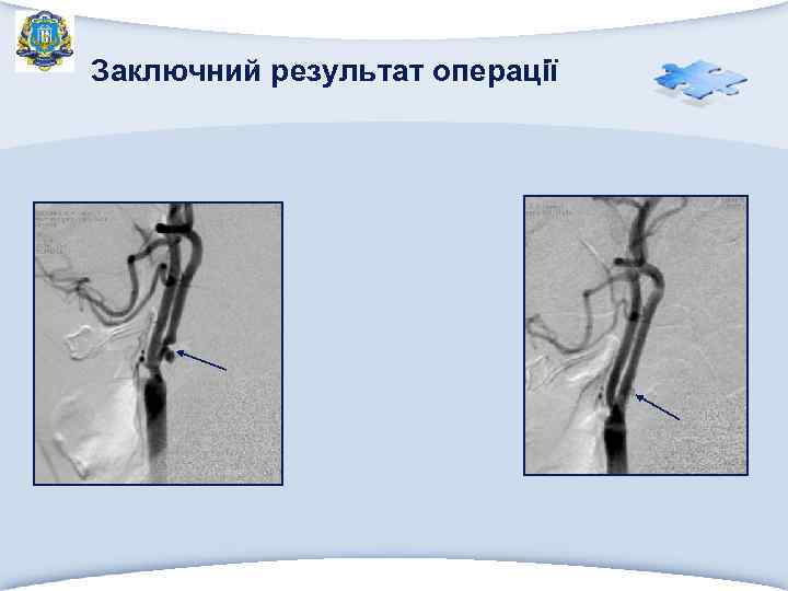 Заключний результат операції 