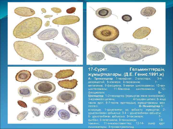 А  Б В  17 -Сурет.   Гельминттердің жұмыртқалары. (Д. Е. Генис.