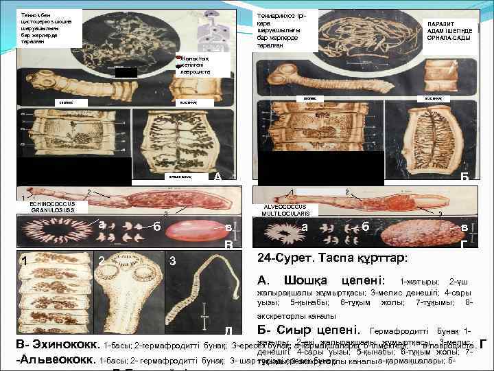  Тениоз бен     Тениаринхоз ірі- цистоцеркоз шошқа   