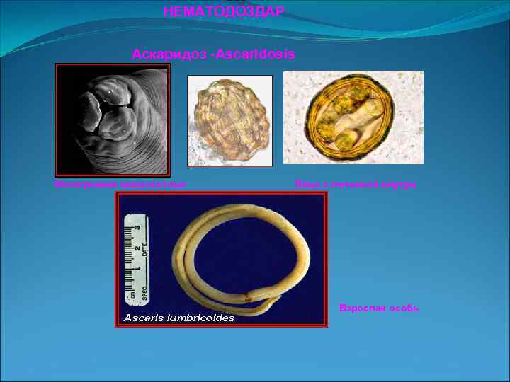     НЕМАТОДОЗДАР    Аскаридоз -Ascaridosis Электронная микроскопия  Яйцо