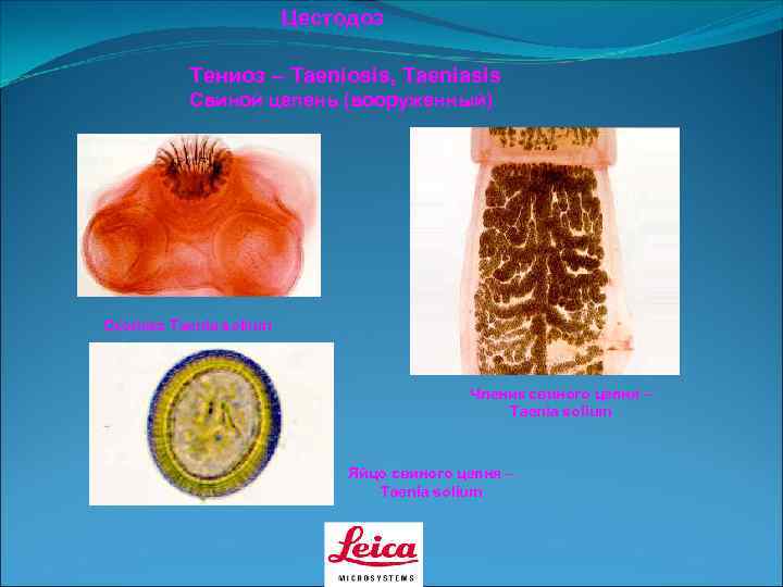     Цестодоз  Тениоз – Taeniosis, Taeniasis  Свиной цепень (вооруженный)