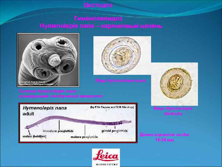      Цестодоз    Гименолепидоз   Hymenolepis nana