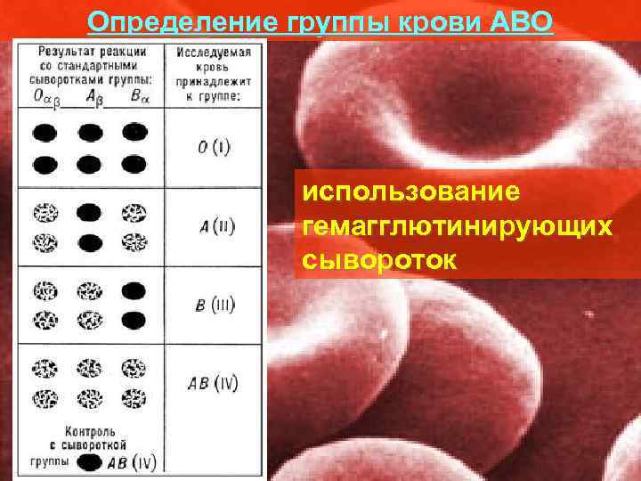 Определение группы крови АВО   использование   гемагглютинирующих   сывороток 