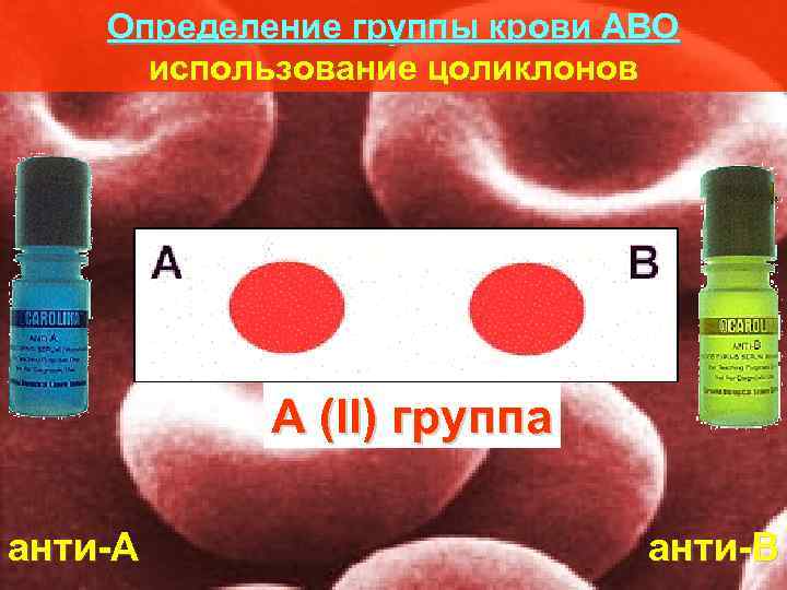   Определение группы крови АВО  использование цоликлонов    А (II)