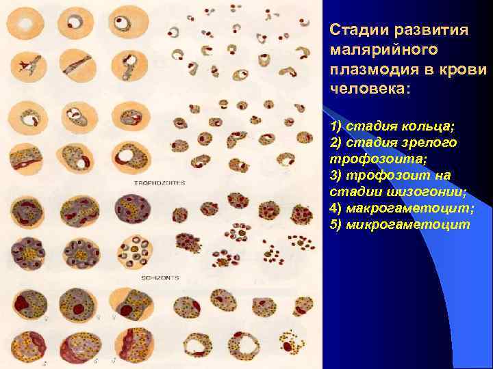 Стадии развития малярийного плазмодия в крови человека: 1) стадия кольца; 2) стадия зрелого Стадии развития малярийного плазмодия в крови человека: 1) стадия кольца; 2) стадия зрелого