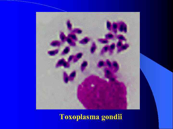 Toxoplasma gondii Toxoplasma gondii