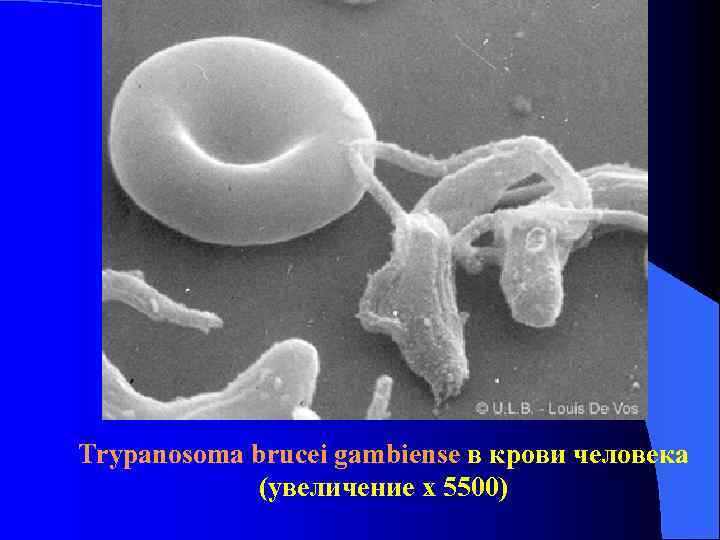 Trypanosoma brucei gambiense в крови человека (увеличение x 5500) Trypanosoma brucei gambiense в крови человека (увеличение x 5500)