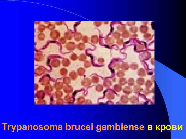 Trypanosoma brucei gambiense в крови Trypanosoma brucei gambiense в крови