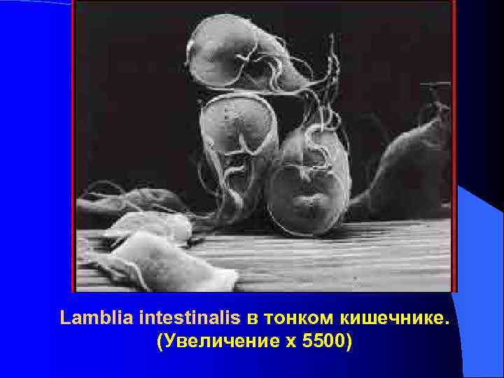 Lamblia intestinalis в тонком кишечнике. (Увеличение x 5500) Lamblia intestinalis в тонком кишечнике. (Увеличение x 5500)