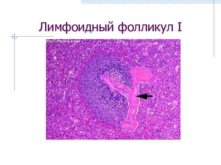 Лимфоидный фолликул I 