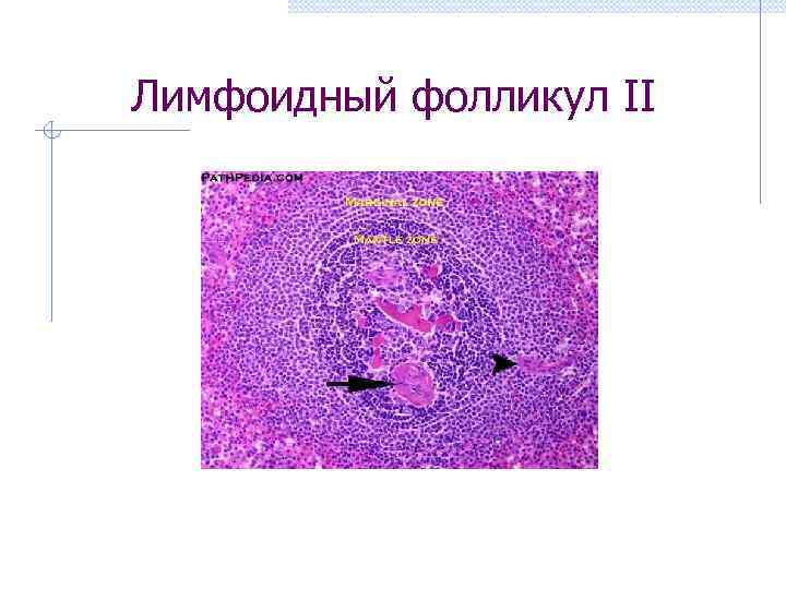 Лимфоидный фолликул II 