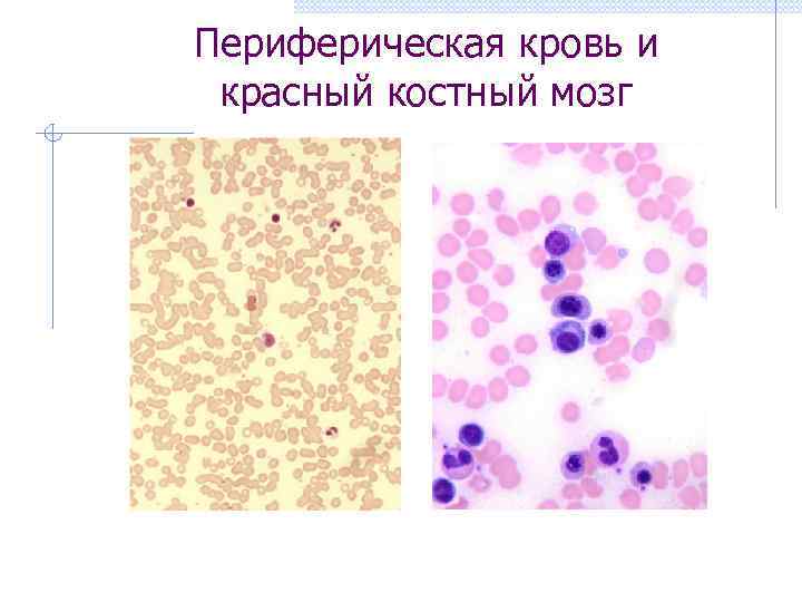 Периферическая кровь и красный костный мозг 