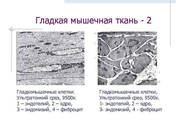   Гладкая мышечная ткань - 2 Гладкомышечные клетки.   Гладкомышечные клетки, 
