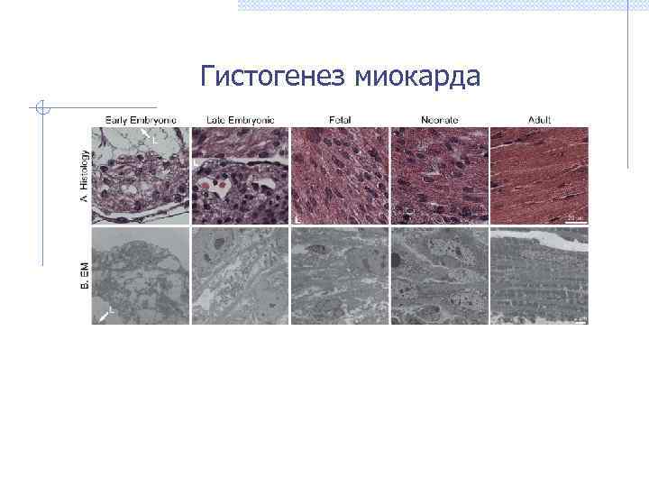   Гистогенез миокарда 
