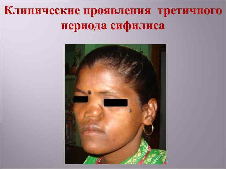 Клинические проявления третичного   периода сифилиса 