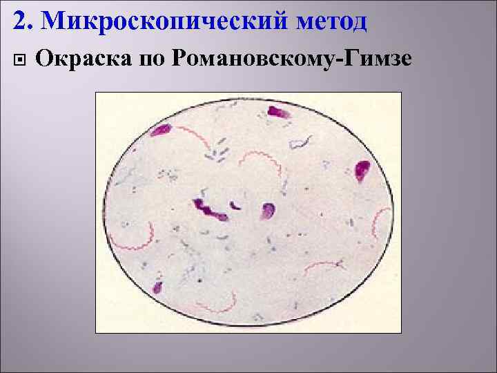 2. Микроскопический метод Окраска по Романовскому-Гимзе 
