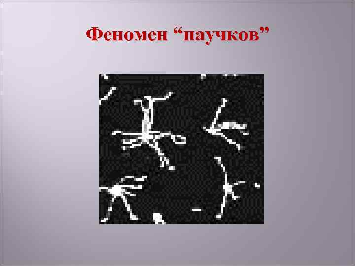 Феномен “паучков” 