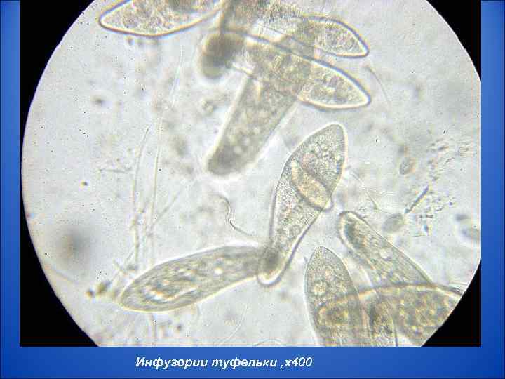 Инфузории туфельки , x 400 