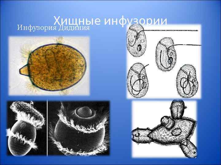 Соотнеси названия органоидов инфузории туфельки с изображением