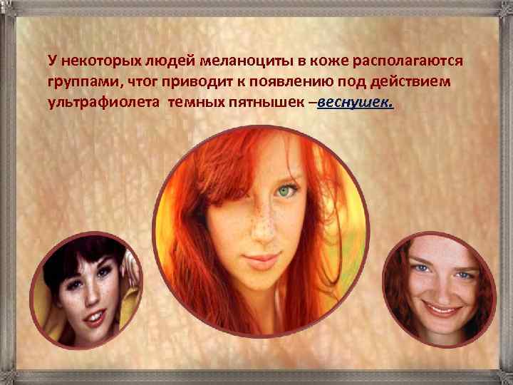 У некоторых людей меланоциты в коже располагаются группами, чтог приводит к появлению под действием