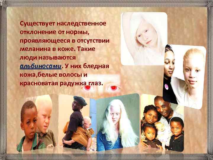 Существует наследственное отклонение от нормы,  проявляющееся в отсутствии меланина в коже. Такие люди