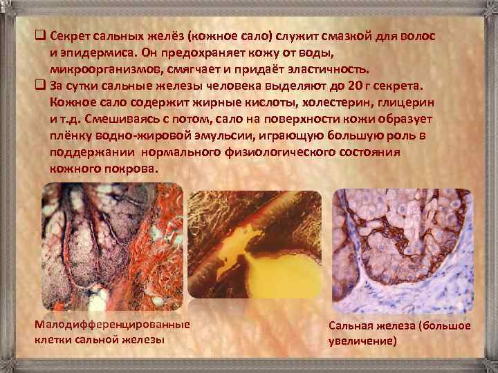 q Секрет сальных желёз (кожное сало) служит смазкой для волос  и эпидермиса. Он