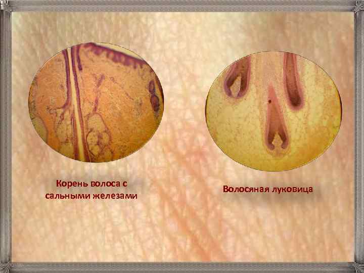  Корень волоса с    Волосяная луковица сальными железами 