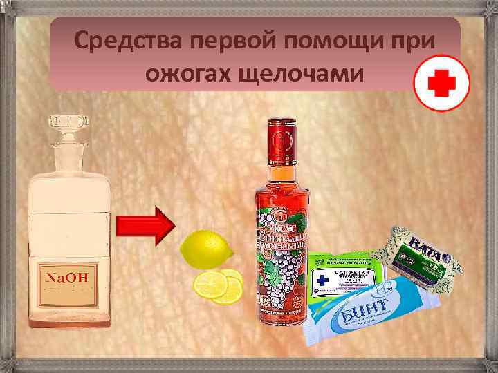 Средства первой помощи при  ожогах щелочами 