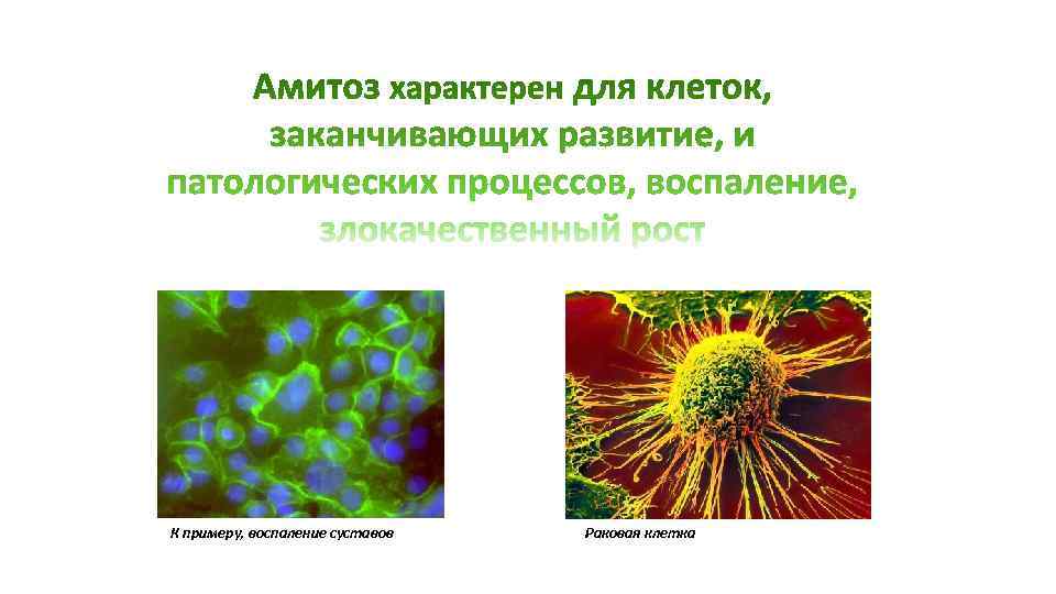 К примеру, воспаление суставов Раковая клетка К примеру, воспаление суставов Раковая клетка