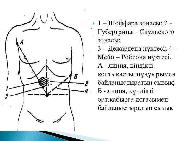 Мейо робсона