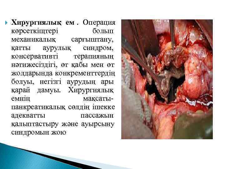   Хирургиялық ем.  Операция көрсеткіщтері   болып механикалық   сарғыштану,