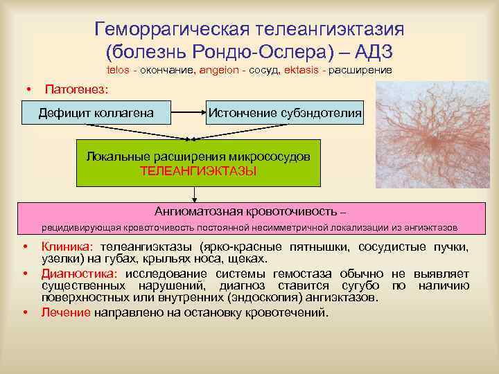    Геморрагическая телеангиэктазия    (болезнь Рондю-Ослера) – АДЗ  