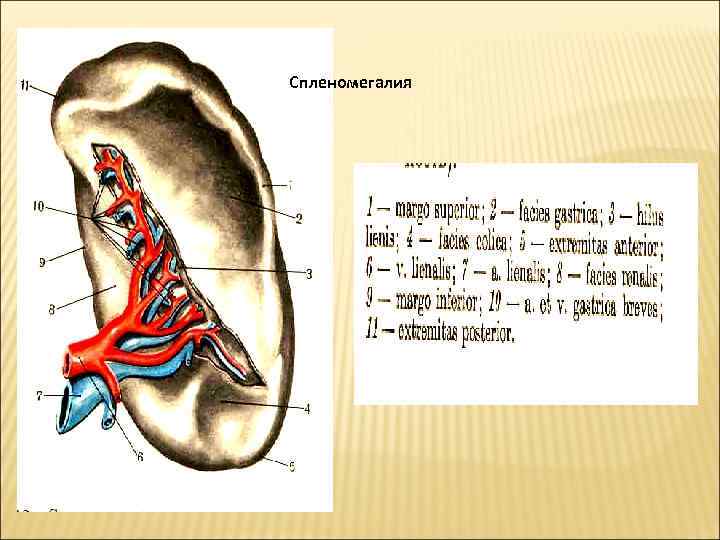  Спленомегалия 