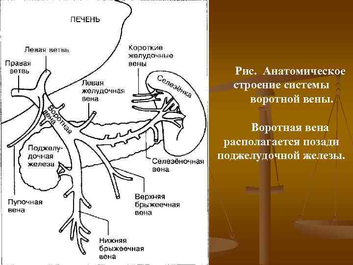  Рис.  Анатомическое  строение системы воротной вены.   Воротная вена 