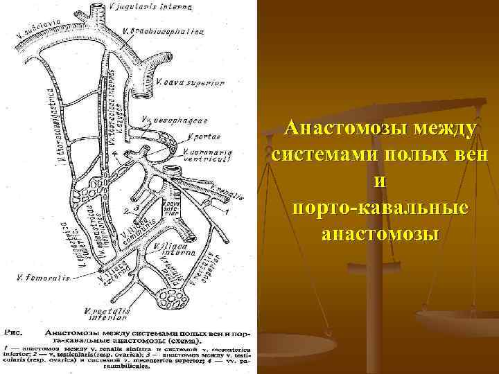  Анастомозы между системами полых вен  и  порто кавальные  анастомозы 