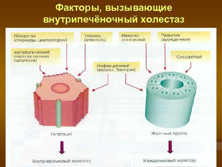  Факторы, вызывающие внутрипечёночный холестаз 