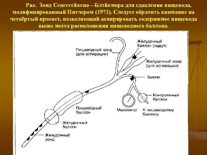 Блэкмор зонд фото