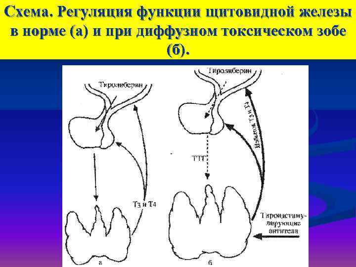 Схема. Регуляция функции щитовидной железы в норме (а) и при диффузном токсическом зобе 